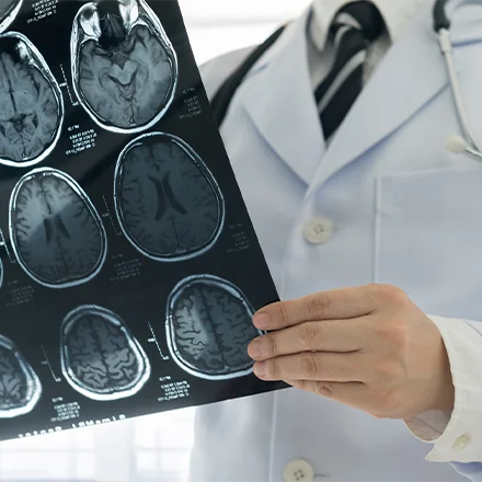 Traumatic Brain Injury